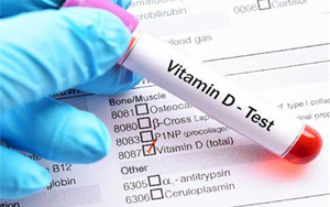 25-羥基維生素D-磁微?；瘜W(xué)發(fā)光法（AE/AP） /熒光免疫層析解決方案（雙抗體夾心法）
