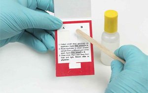 大便隱血（FOB）-免疫層析（膠體金、彩色乳膠及熒光免疫層析）解決方案