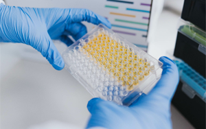 免疫技術(shù)新視界：層析、印跡、吸附與比濁的前沿碰撞