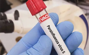 副流感病毒（HPIV1、2、3型）抗原檢測-免疫層析 （膠體金、彩色乳膠及熒光免疫層析）解決方案