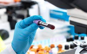 【FAPGG】，血管緊張素轉(zhuǎn)換酶檢測用底物