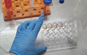 精準(zhǔn)營(yíng)養(yǎng)，塑造未來(lái)：類(lèi)器官培養(yǎng)基的新紀(jì)元