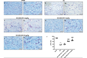 GSK-343通過抑制EZH2減輕小鼠脊髓損傷后的神經(jīng)炎癥：靶向TRAF6/NF-κB通路的新表觀遺傳策略
