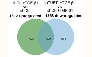 TUFT1通過穩(wěn)定TβRII蛋白促進(jìn)肝星狀細(xì)胞活化為促轉(zhuǎn)移肌成纖維細(xì)胞的新機(jī)制及其在結(jié)直腸癌肝轉(zhuǎn)移中的作用