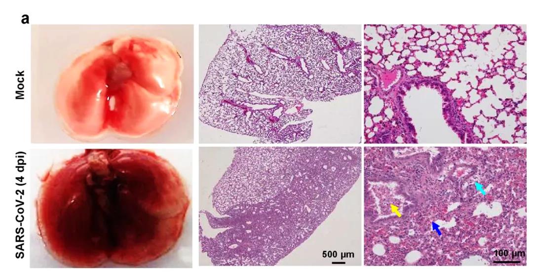 ?建模成功！Nature子刊：成功建立新冠肺炎重癥模型，揭示新冠病毒感染的分子機(jī)制