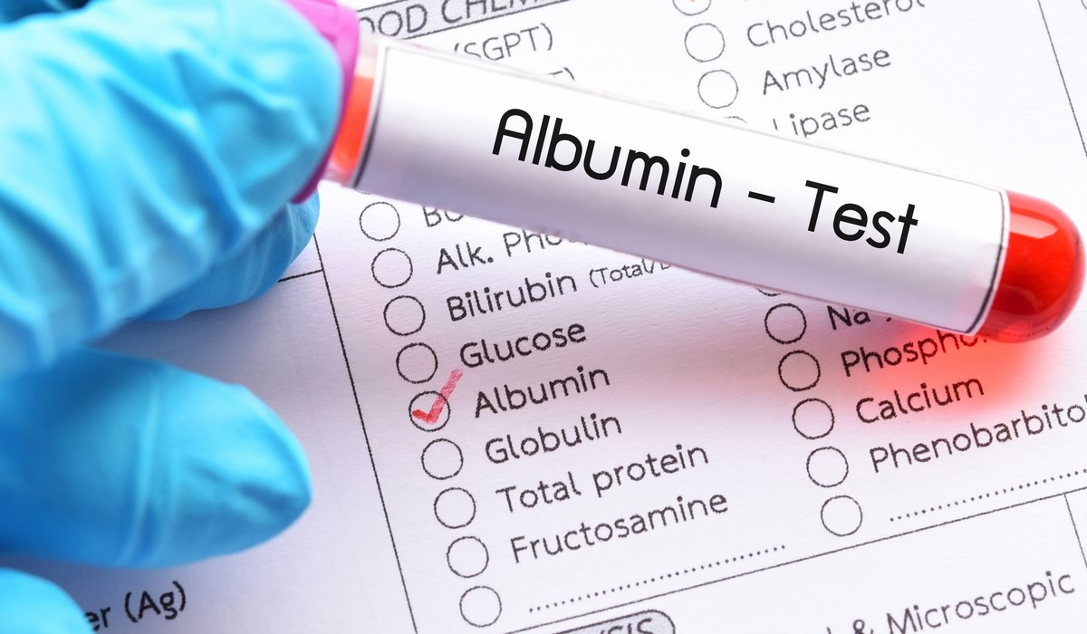 白蛋白檢測(cè) 白蛋白檢測(cè)