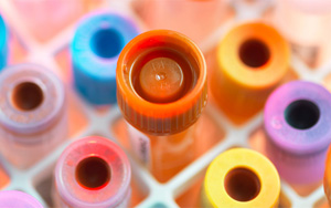 總蛋白（TP）檢測(cè)試劑盒用原輔料