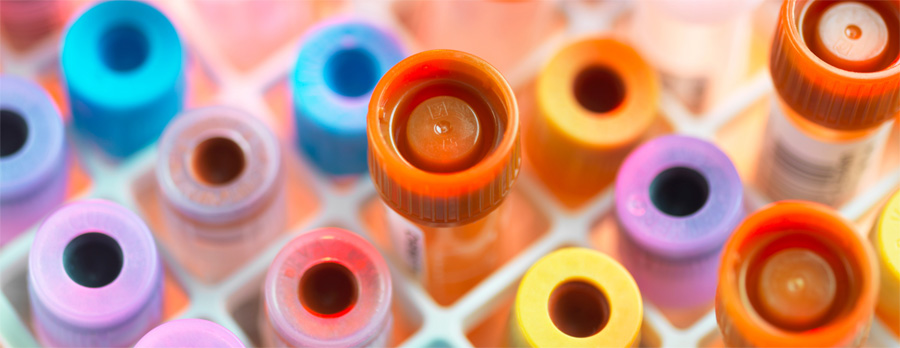 總蛋白檢測 總蛋白檢測