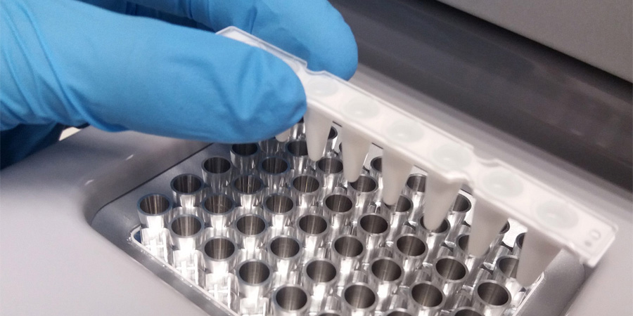 銅藍(lán)蛋白檢測 銅藍(lán)蛋白檢測