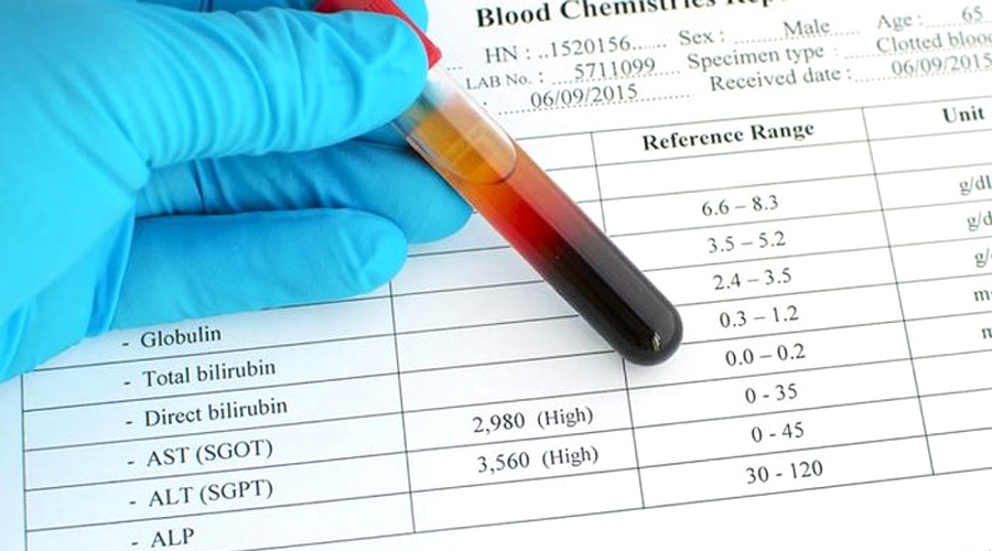 谷丙轉氨酶(ALT)檢測 谷丙轉氨酶(ALT)檢測