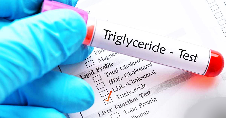 甘油三酯(TG)檢測(cè)