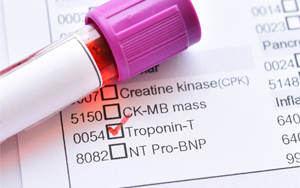 心肌肌鈣蛋白T（cTnT）-磁微?；瘜W(xué)發(fā)光法（吖啶酯） /熒光免疫層析解決方案