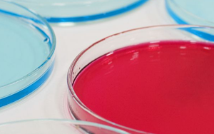 微生物檢測(cè)用培養(yǎng)基升級(jí)—顯色培養(yǎng)基